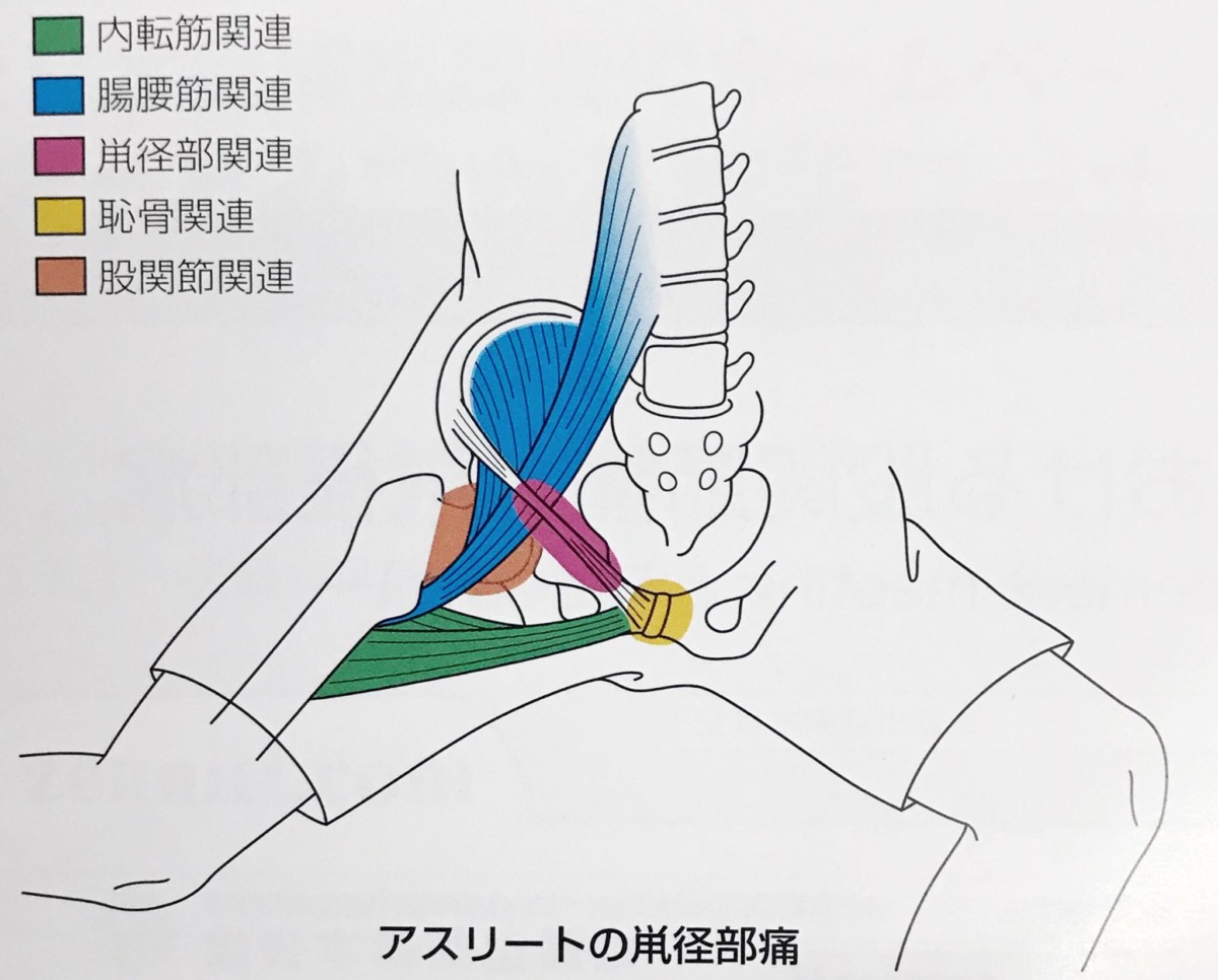 歩く と 鼠径 部 が 痛い